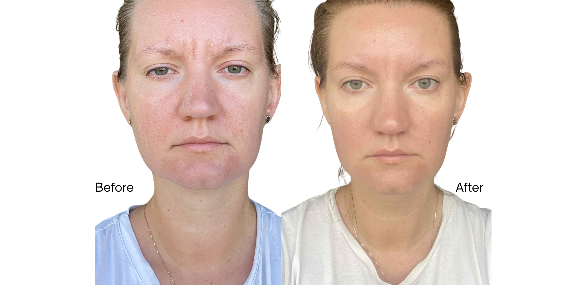Full Face 14-Day Sculpting Program + prezent Beauty Tapes